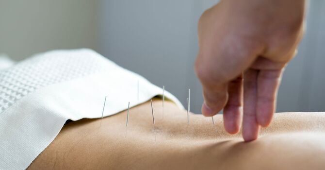 Chronic Pain Support Acupuncture｜慢性疼痛针灸